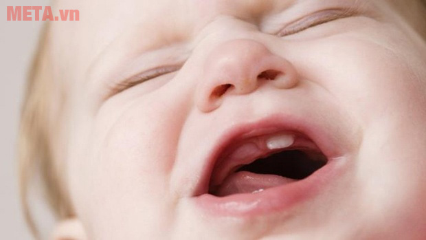 Bé mọc răng Những cách hiệu quả trị biếng ăn cho từng nhóm trẻ