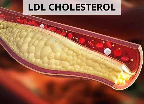 ldl cholesterol ldl cholesterol là gì