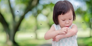 12 mẹo đơn giản trị muỗi đốt cho bé 