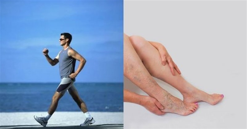 Bị giãn tĩnh mạch chân có tập thể dục, yoga, đi bộ, chạy bộ được không?