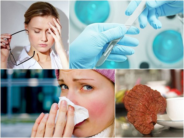 Những người không nên dùng nấm linh chi