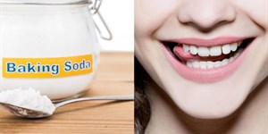 Baking soda làm trắng răng được không? Cách làm như thế nào?