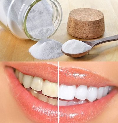 Làm trắng răng bằng baking soda khô Làm trắng răng bằng baking soda khô