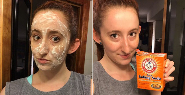 Trị mụn đầu đen bằng baking soda