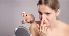 Cách trị mụn đầu đen ở mũi tại nhà nhờ mặt nạ từ nguyên liệu đơn giản