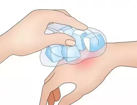 Dùng đá lạnh sơ cứu