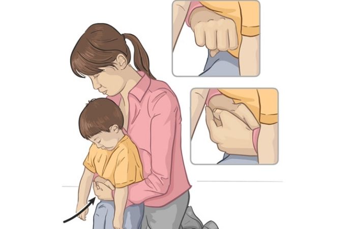 Cách chữa hóc xương cá theo kinh nghiệm dân giân