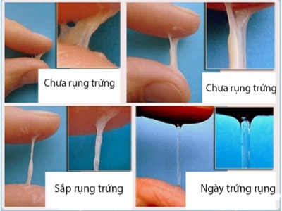 Dấu hiệu nhận biết kỳ rụng trứng Dấu hiệu nhận biết kỳ rụng trứng