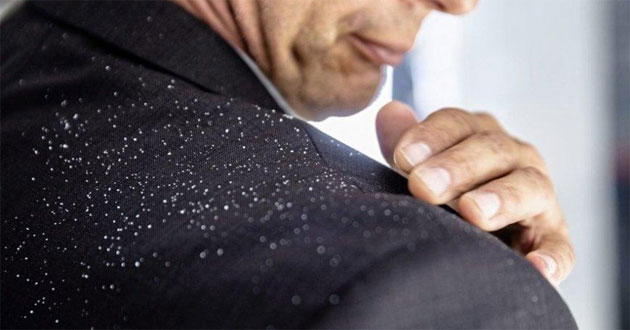 Dầu gội trị gàu tốt nhất cho nữ, nam, trẻ em Dầu gội trị gàu tốt nhất cho nữ, nam, trẻ em