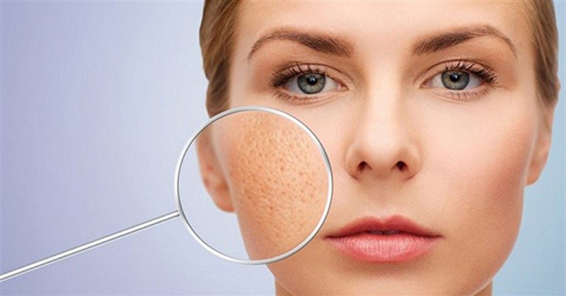6 Mặt nạ se khít lỗ chân lông cho da nhờn hiệu quả, dễ thực hiện tại nhà