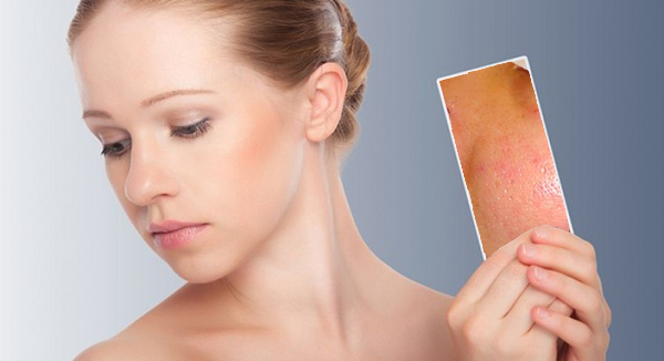 Nguyên nhân gây tình trạng lỗ chân lông to