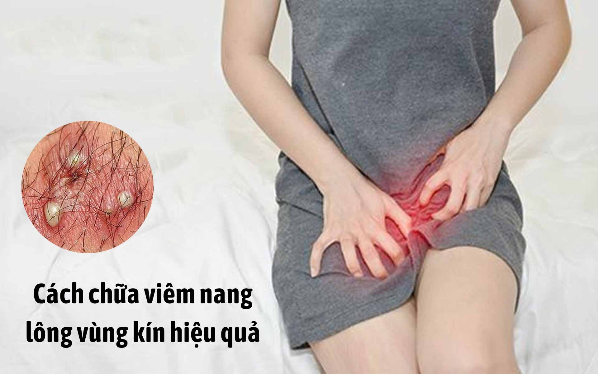 Tìm hiểu về viêm nang lông vùng kín