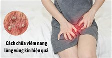 Nguyên nhân và cách trị viêm nang lông vùng kín an toàn, hiệu quả