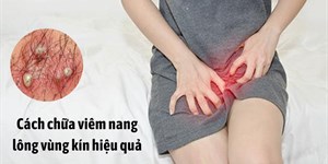 Nguyên nhân và cách trị viêm nang lông vùng kín an toàn, hiệu quả