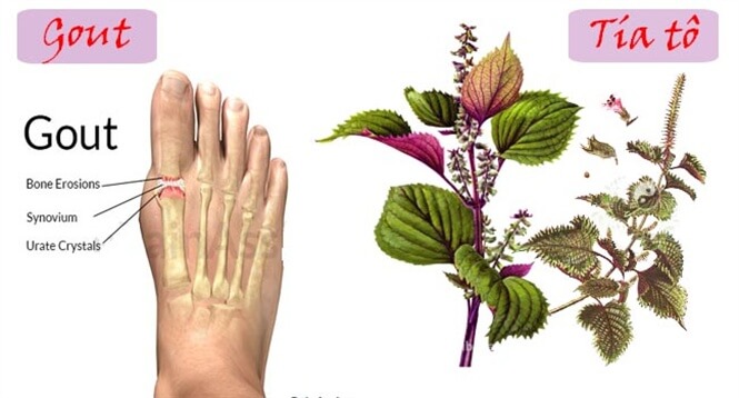 Cách sử dụng lá tía tô để chữa bệnh Gout Cách sử dụng lá tía tô để chữa bệnh Gout