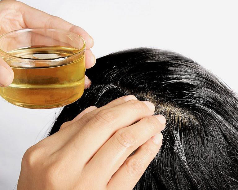 Trị gàu bằng dầu dừa Trị gàu bằng dầu dừa