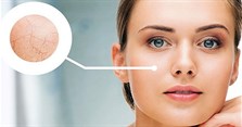 6 cách đối phó với da mặt khô nứt nẻ vào mùa đông hiệu quả tại nhà
