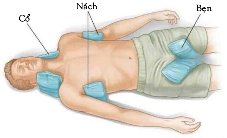 Cách xử lý say nắng