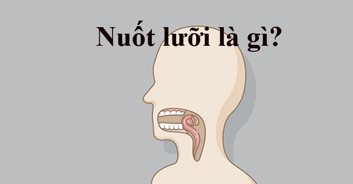 Nuốt lưỡi là gì? Nuốt lưỡi là gì?