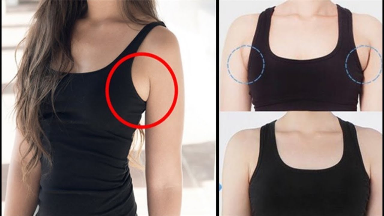 Mỡ nách là gì? Mỡ ở nách nhiều do đâu? Mỡ nách là gì? Mỡ ở nách nhiều do đâu?