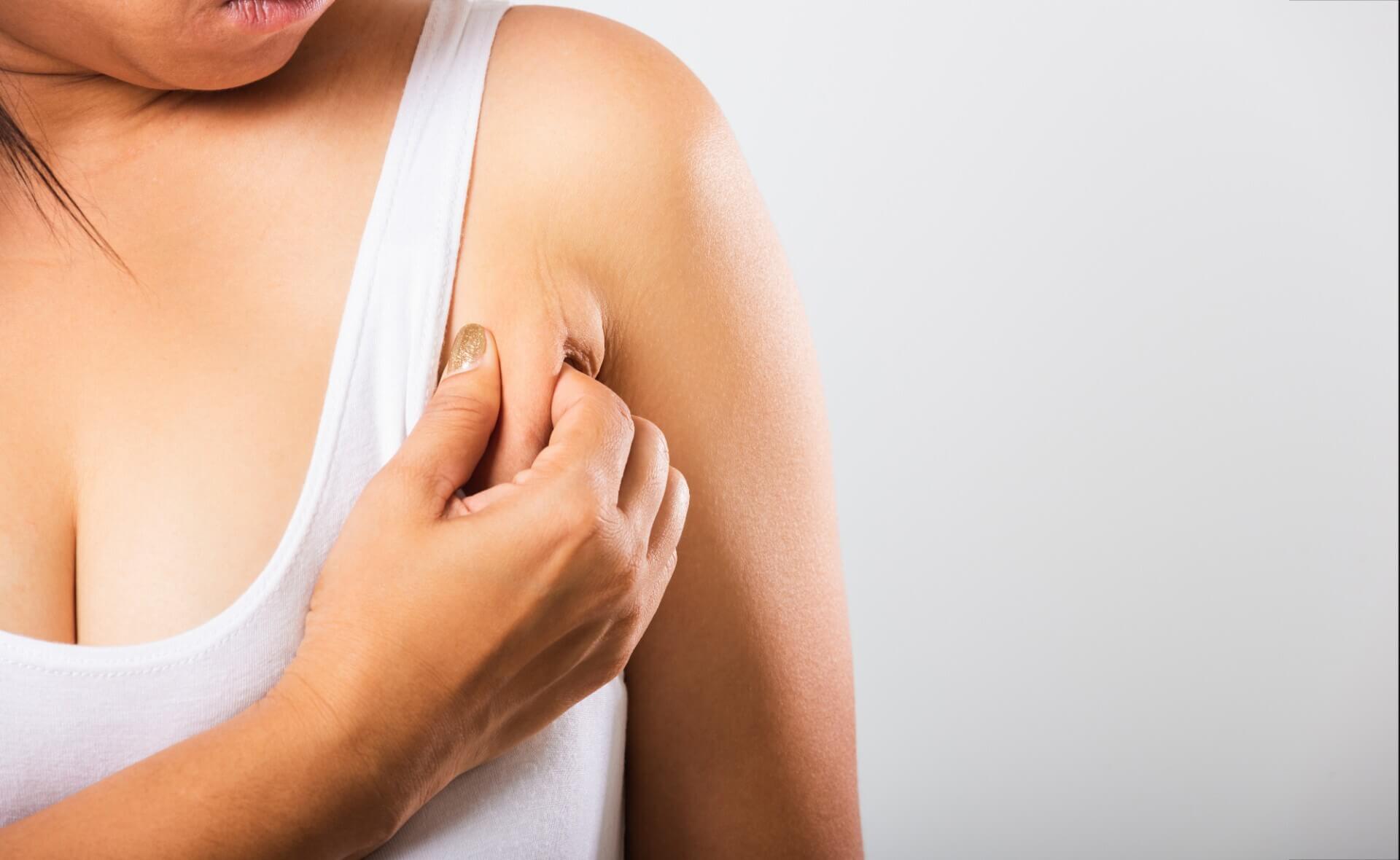 Cách giảm mỡ nách tại nhà Cách giảm mỡ nách tại nhà