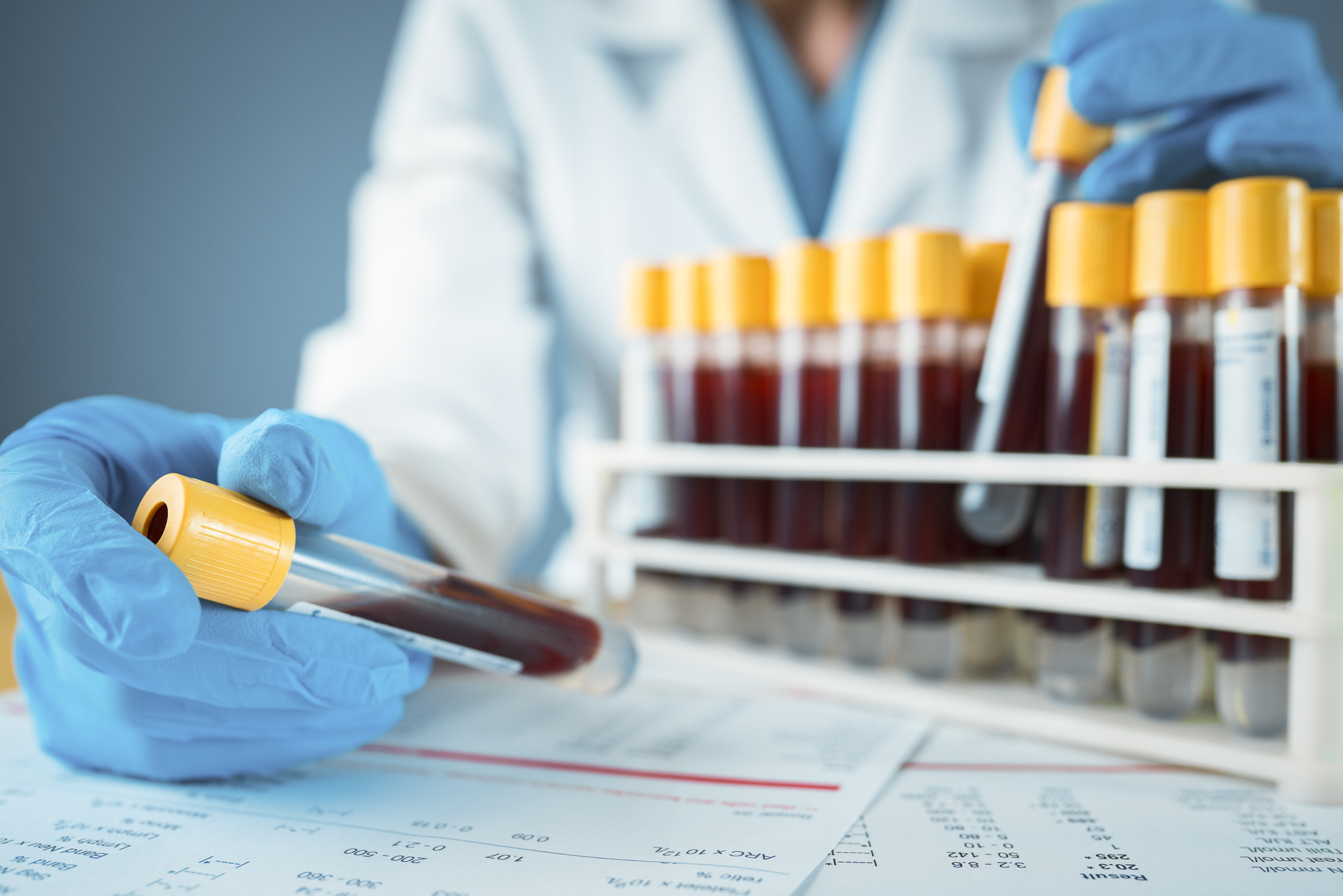 Cách nhận biết nhóm máu AB như thế nào?