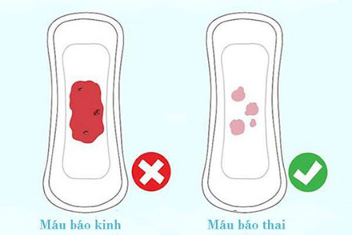 Cách phân biệt máu báo thai với máu báo khác