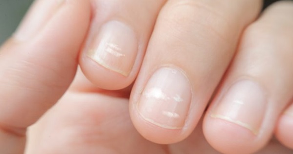 Móng chân móng tay