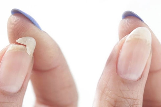 Móng chân móng tay