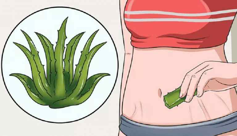 Cách trị rạn da bằng nha đam Cách trị rạn da bằng nha đam