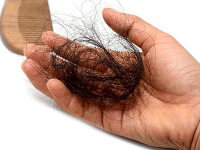 Mùa rụng tóc là mùa nào? Rụng tóc theo mùa có nguy hiểm không?