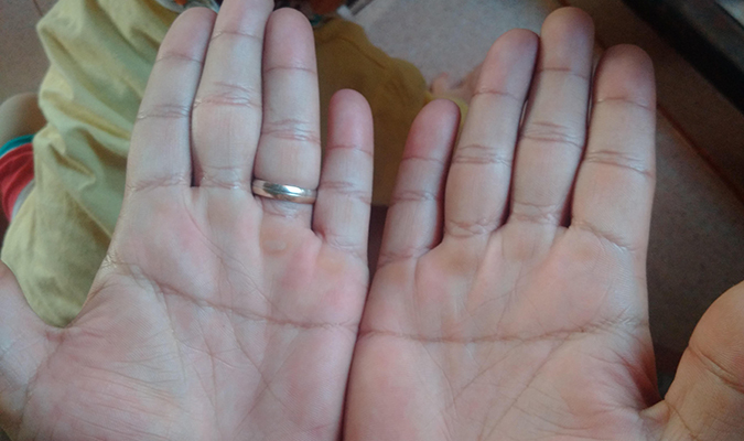 Một số đường chỉ tay lạ hiếm gặp khác Một số đường chỉ tay lạ hiếm gặp khác