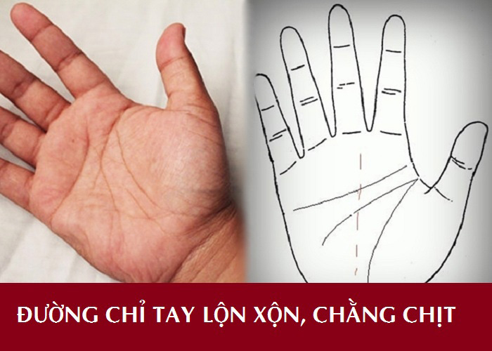 Đường chỉ tay không nên có