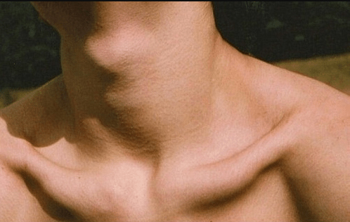 Yết hầu của nam giới to có sao không? Yết hầu của nam giới to có sao không?