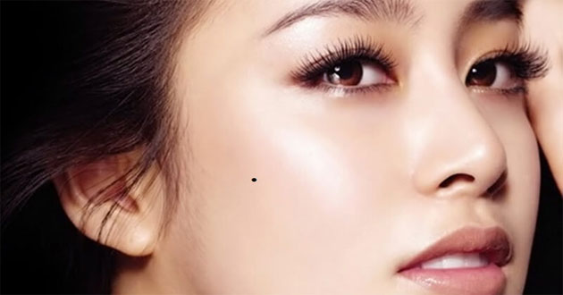 Ý nghĩa nốt ruồi trên gò má