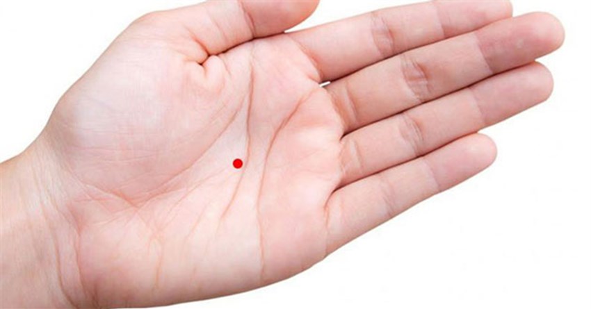 Nốt ruồi son là gì? Hình ảnh và ý nghĩa nốt ruồi son