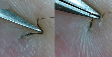 Dùng nhíp chuyên dụng Dùng nhíp chuyên dụng