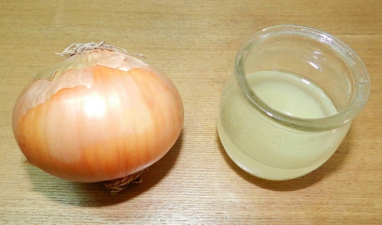 Cách tẩy nốt ruồi tại nhà bằng nước ép hành tây