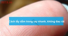Cách lấy dằm trong tay nhanh, hiệu quả, không đau rát
