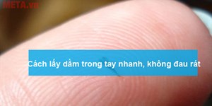 Cách lấy dằm trong tay nhanh, hiệu quả, không đau rát