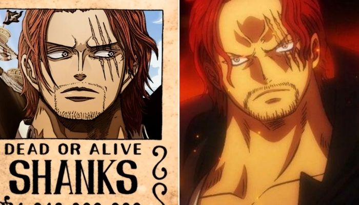 Shanks