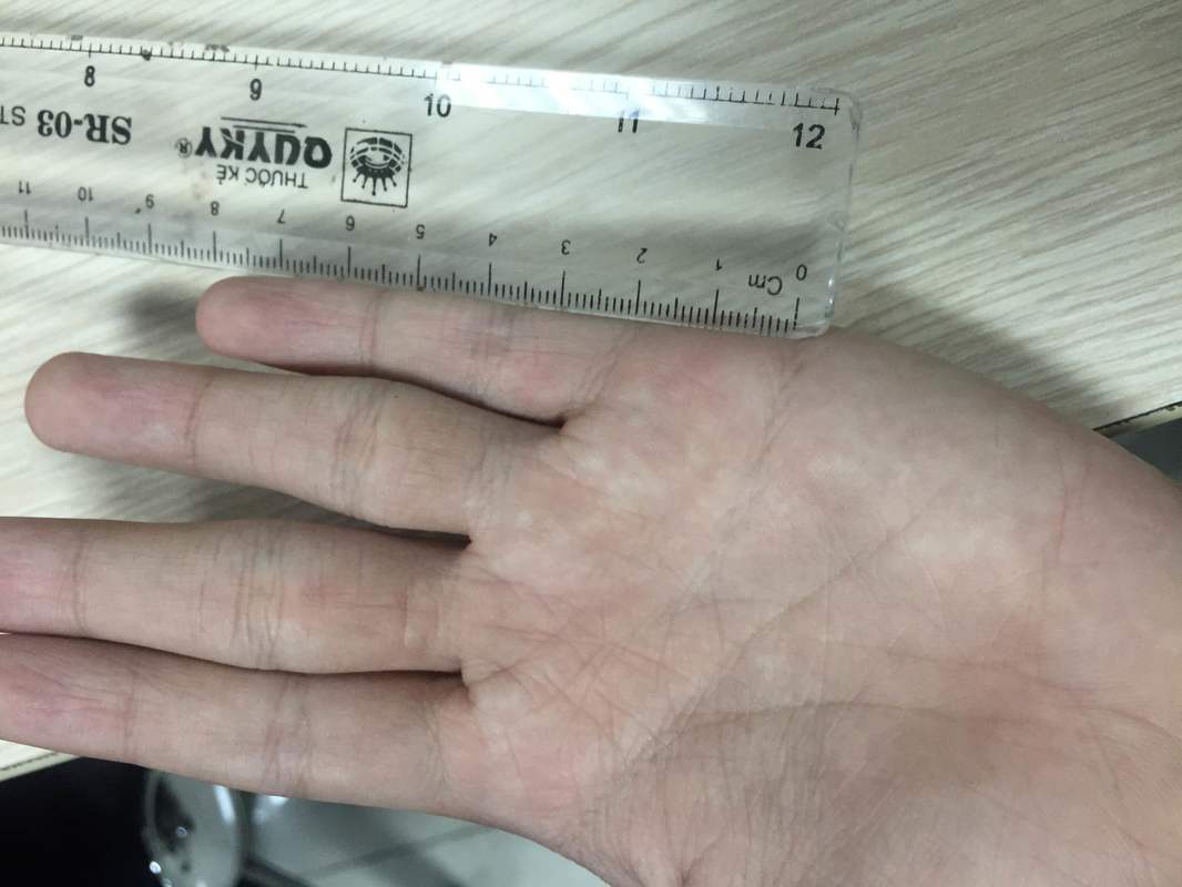 Hé lộ tuổi kết hôn bằng cách đo chỉ tay siêu chuẩn