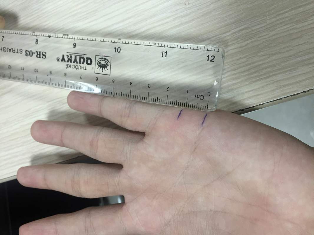 Hé lộ tuổi kết hôn bằng cách đo chỉ tay siêu chuẩn