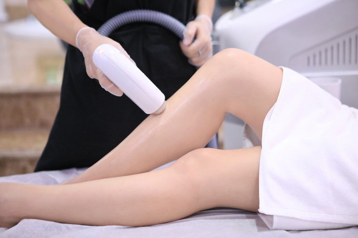 Triệt lông vĩnh viễn là một quá trình lâu dài với các mốc thực hiện rõ ràng