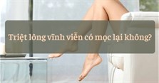 Giải đáp: Triệt lông vĩnh viễn có mọc lại không?