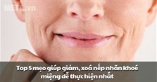 Top 5 mẹo giúp giảm, xoá nếp nhăn khoé miệng dễ thực hiện nhất