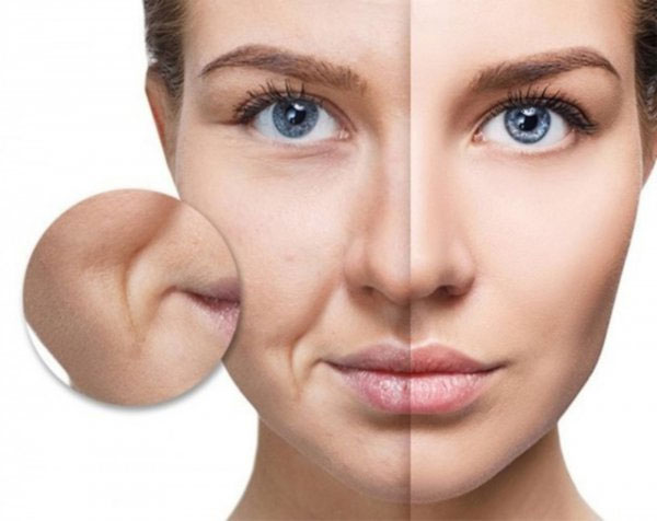 Hình ảnh nếp nhăn khóe miệng