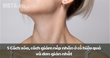 4 Cách xóa, cách giảm nếp nhăn ở cổ hiệu quả và đơn giản nhất