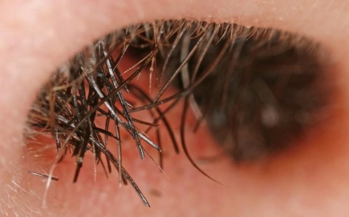 Lông mũi có tác dụng gì?