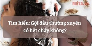 Tìm hiểu: Gội đầu thường xuyên có hết chấy không?